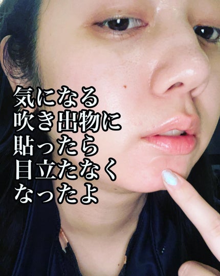 グリーンカーミングブルーレーションクリーンアンプル/obsero/美容液を使ったクチコミ(5枚目)