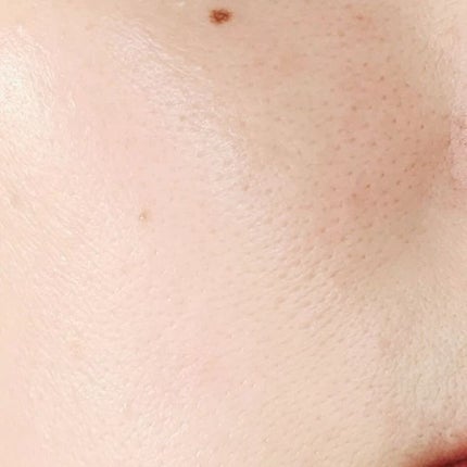 フルフィットプロポリスライトアンプル/COSRX/美容液を使ったクチコミ(7枚目)