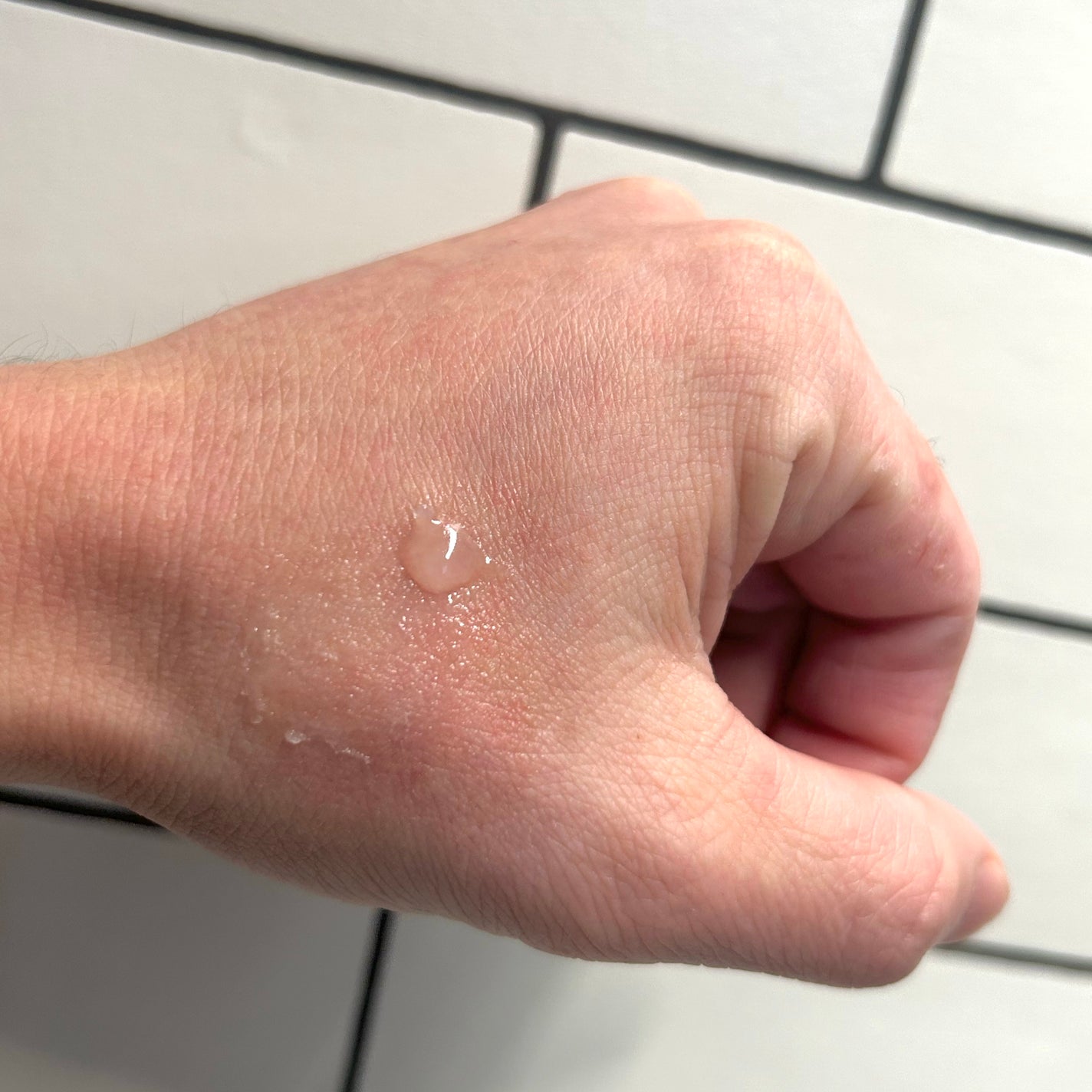 CICA method RECOVER PATCH/コジット/その他スキンケアを使ったクチコミ(3枚目)