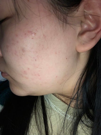 導入化粧液/無印良品/ブースター・導入液を使ったクチコミ(3枚目)