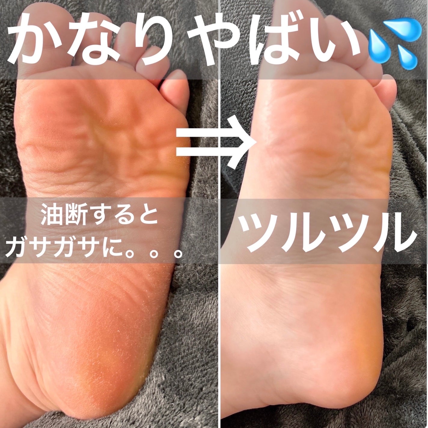 イージーパックDP60分タイプ/ベビーフット/レッグ・フットケアを使ったクチコミ(4枚目)