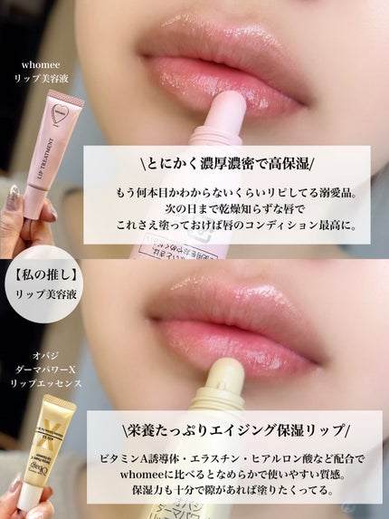 ダーマパワーX リップエッセンス/オバジ/リップ美容液を使ったクチコミ(7枚目)