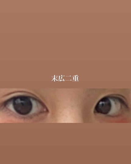 ルドゥーブル/ルドゥーブル/二重まぶた用アイテムを使ったクチコミ(3枚目)