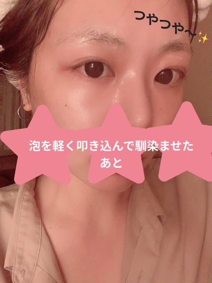 ブライトニング バブルトックス セラムマスク/MEDIHEAL/シートマスク・パックを使ったクチコミ(4枚目)