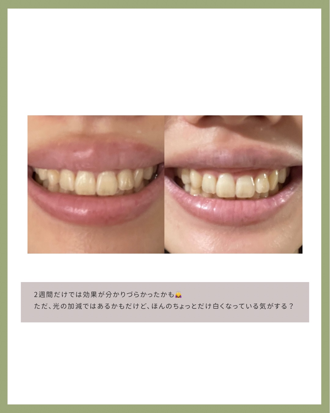 ホワイトパープル歯みがき ピーチフローラルミントの香り/EUTHYMOL/歯磨き粉を使ったクチコミ（3枚目）