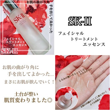 フェイシャル トリートメント エッセンス/SK-II/化粧水を使ったクチコミ（4枚目）