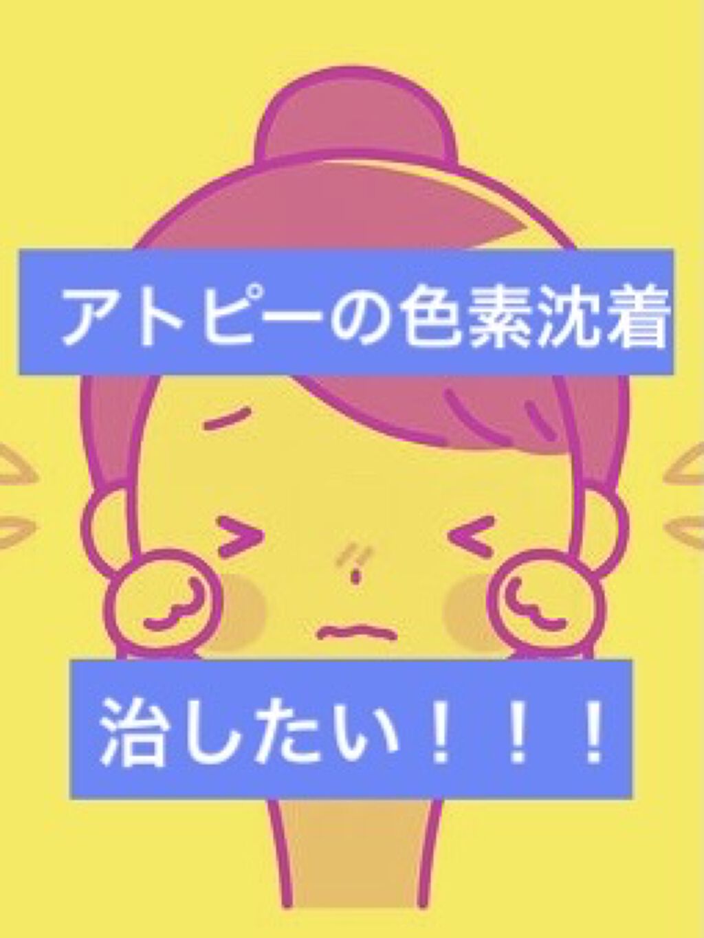 ローション/キュレル/ボディローションを使ったクチコミ（1枚目）