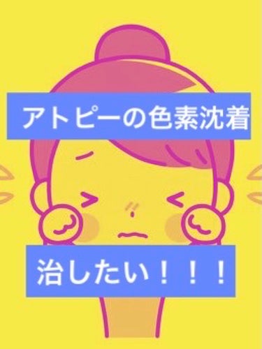 アトピーの色素沈着で悩んでいます🥲
私なりのケアを投稿するので、他にいい方法があれば、コメントしていただけると嬉しいです🥰

(今の状態
→痒みは基本ない。生理前は痒くなる。
     首、背中、脇、胸