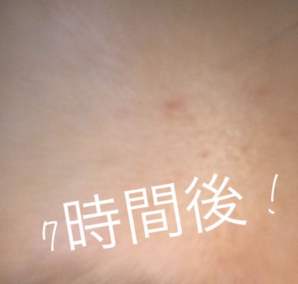 トラブルキュア/美肌ファクトリー/シートマスク・パックを使ったクチコミ(3枚目)