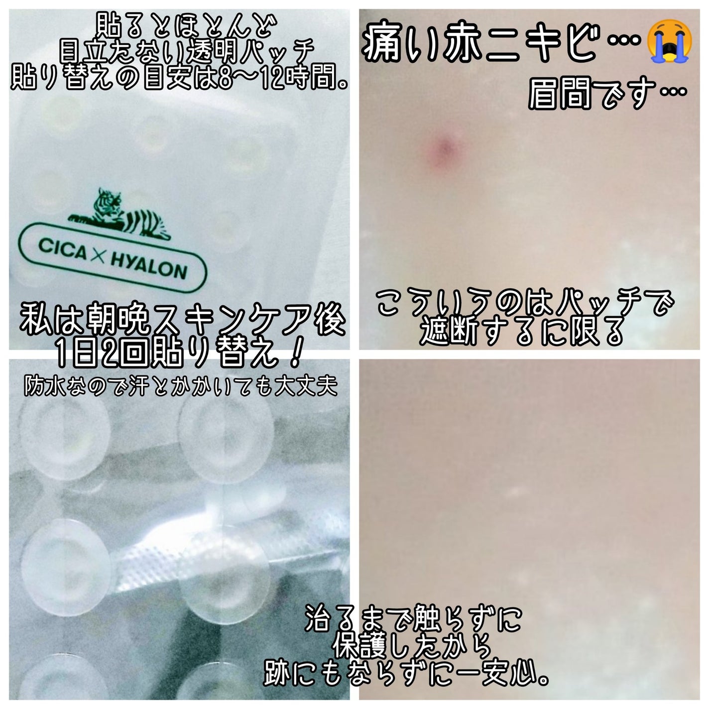 プロCICA クリアスポットパッチ/VT/その他スキンケアを使ったクチコミ(2枚目)