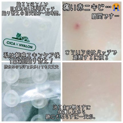 プロCICA クリアスポットパッチ/VT/その他スキンケアを使ったクチコミ(2枚目)