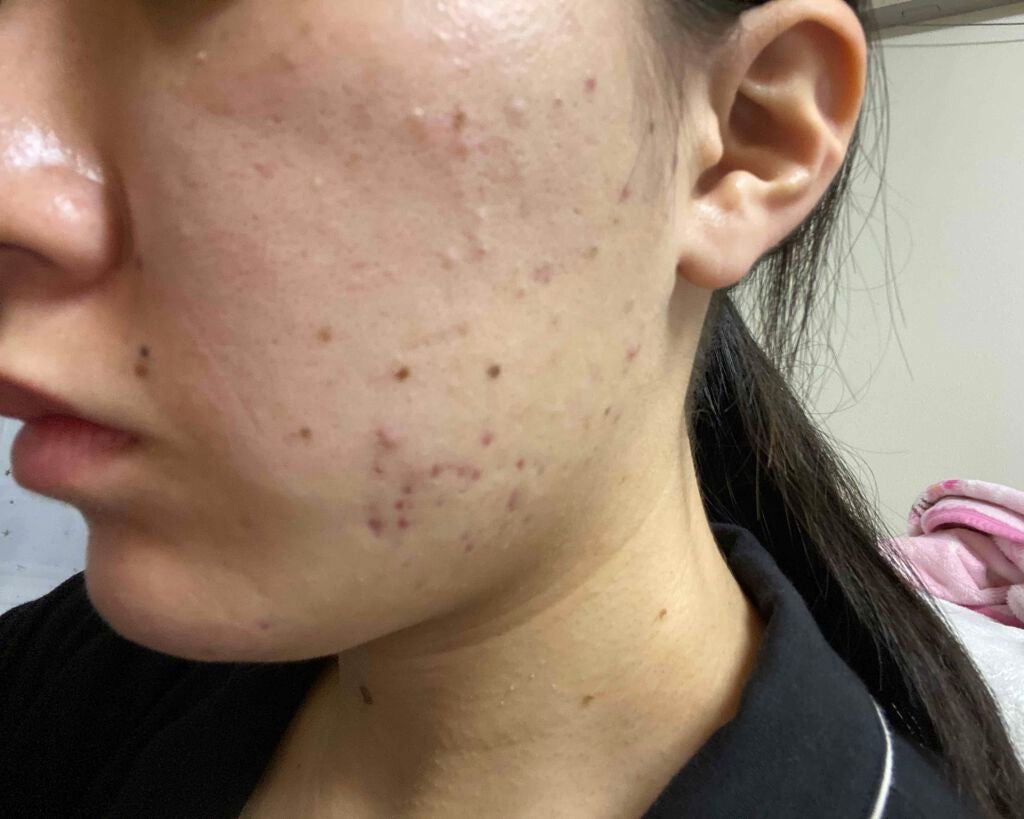 ララ on LIPS 「助けてください!!専門学校1年で今19歳です。学校が看護という..」(2枚目)