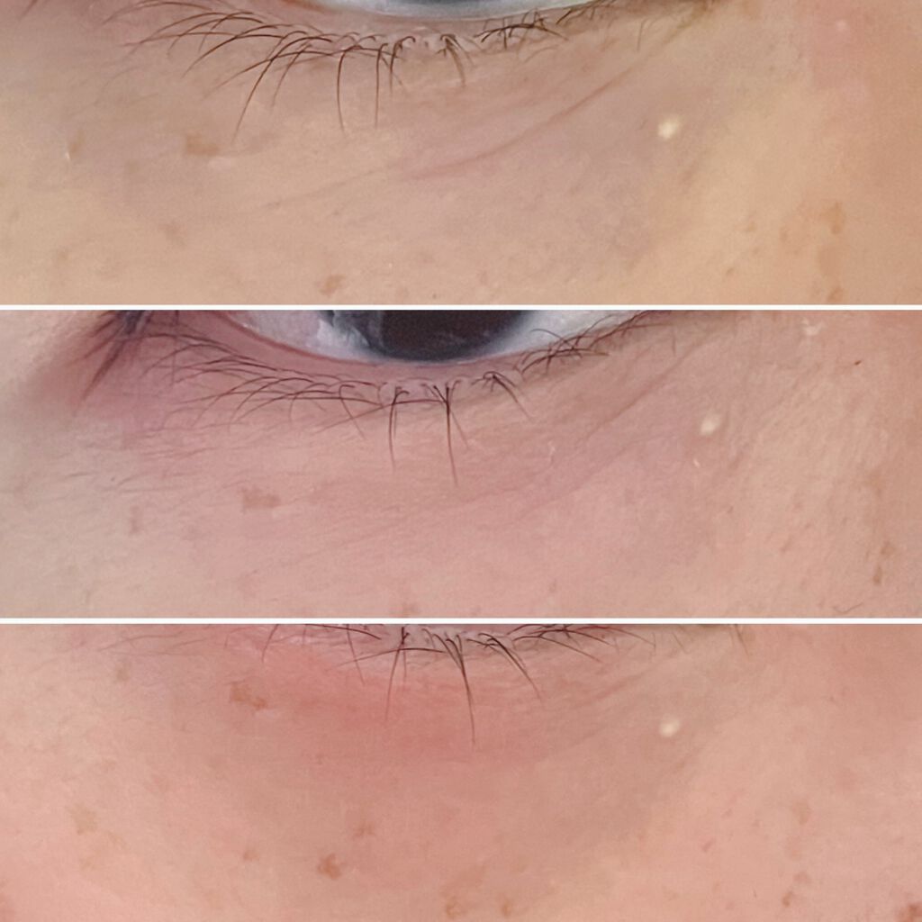 エリクシール シュペリエル エンリッチド リンクルクリーム/エリクシール/アイケア・アイクリームを使ったクチコミ(2枚目)