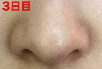 ディープクリア酵素洗顔 /メラノCC/洗顔フォームを使ったクチコミ(5枚目)