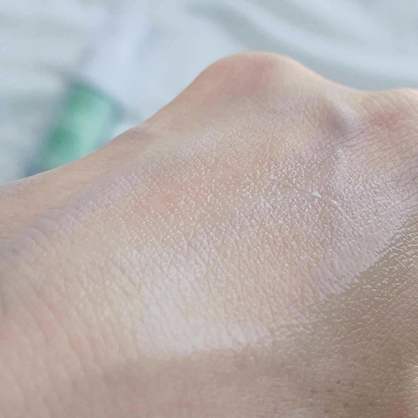 シカレチA エッセンス0.1/VT/美容液を使ったクチコミ(4枚目)