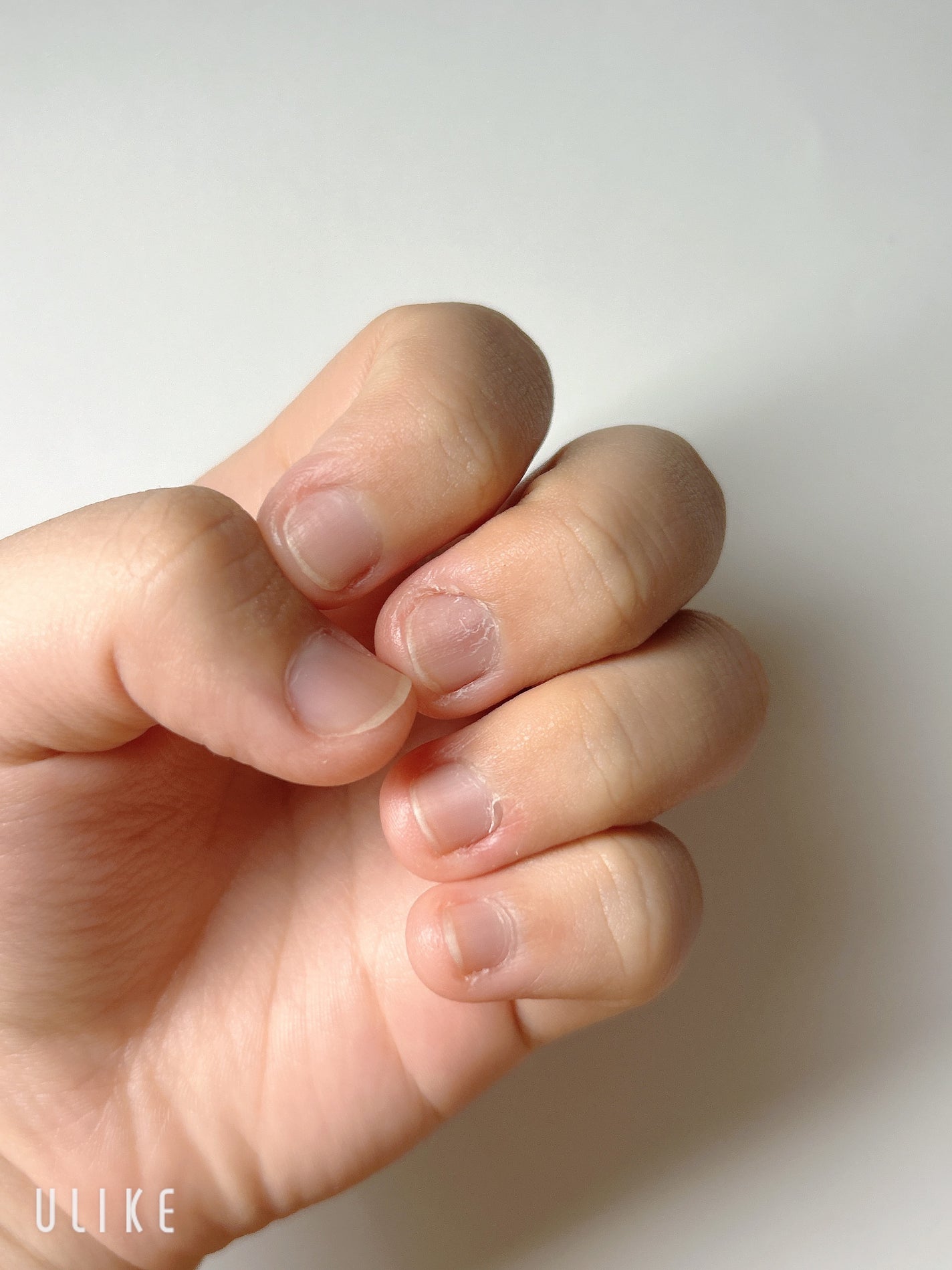 ネイルトリートメント Na/ネイルネイル/ネイルオイル・トリートメントを使ったクチコミ(6枚目)