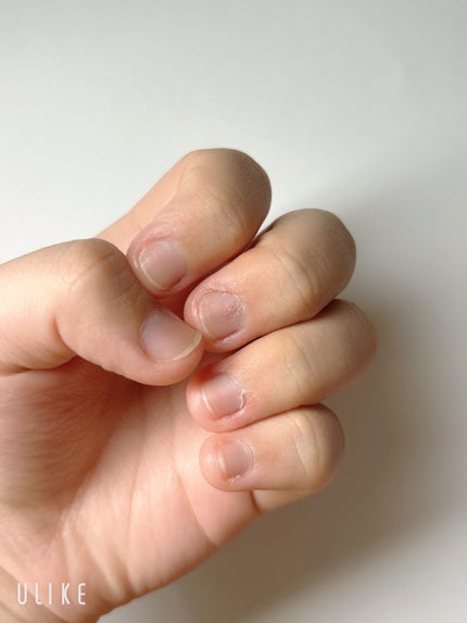 ネイルトリートメント Na/ネイルネイル/ネイルオイル・トリートメントを使ったクチコミ(6枚目)