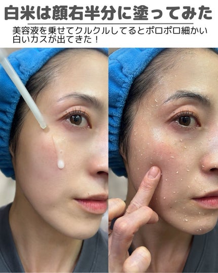 白米ピールショットゴマージュアンプル/Dr.Melaxin/美容液を使ったクチコミ(5枚目)