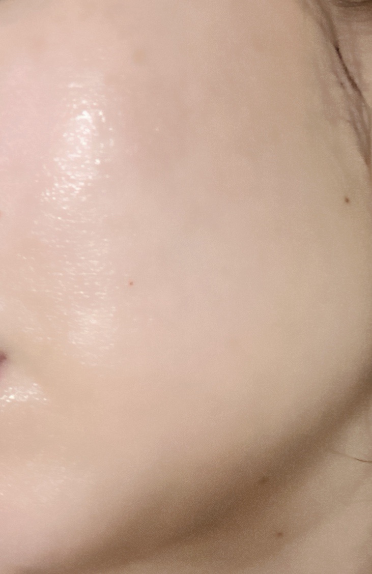 ネイチャーコンク 薬用クリアローション/ネイチャーコンク/拭き取り化粧水を使ったクチコミ（2枚目）