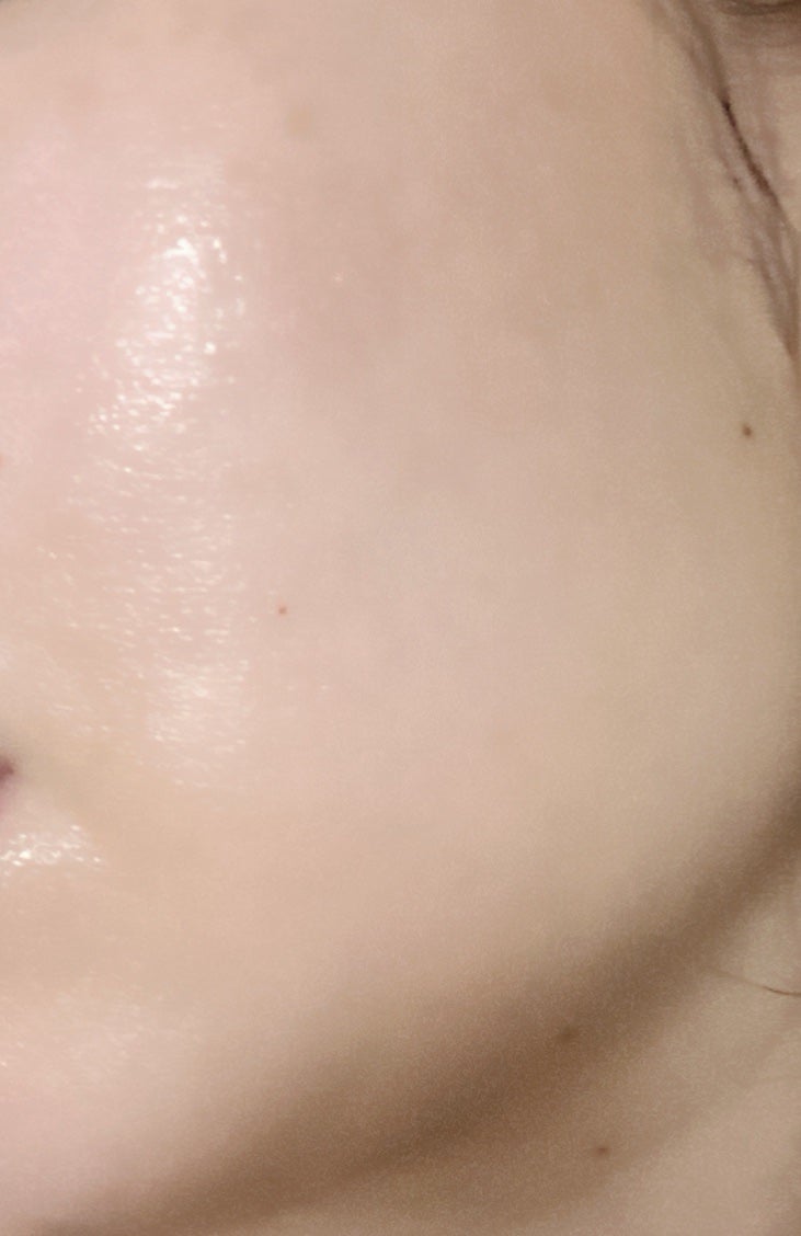 ネイチャーコンク 薬用クリアローション/ネイチャーコンク/拭き取り化粧水を使ったクチコミ(2枚目)