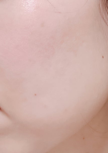 RXザ・ビタミンC23セラム/COSRX/美容液を使ったクチコミ(2枚目)