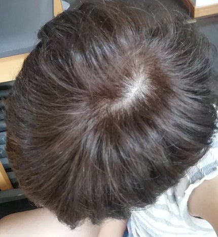 泡カラー/リーゼ/ヘアカラーを使ったクチコミ(5枚目)