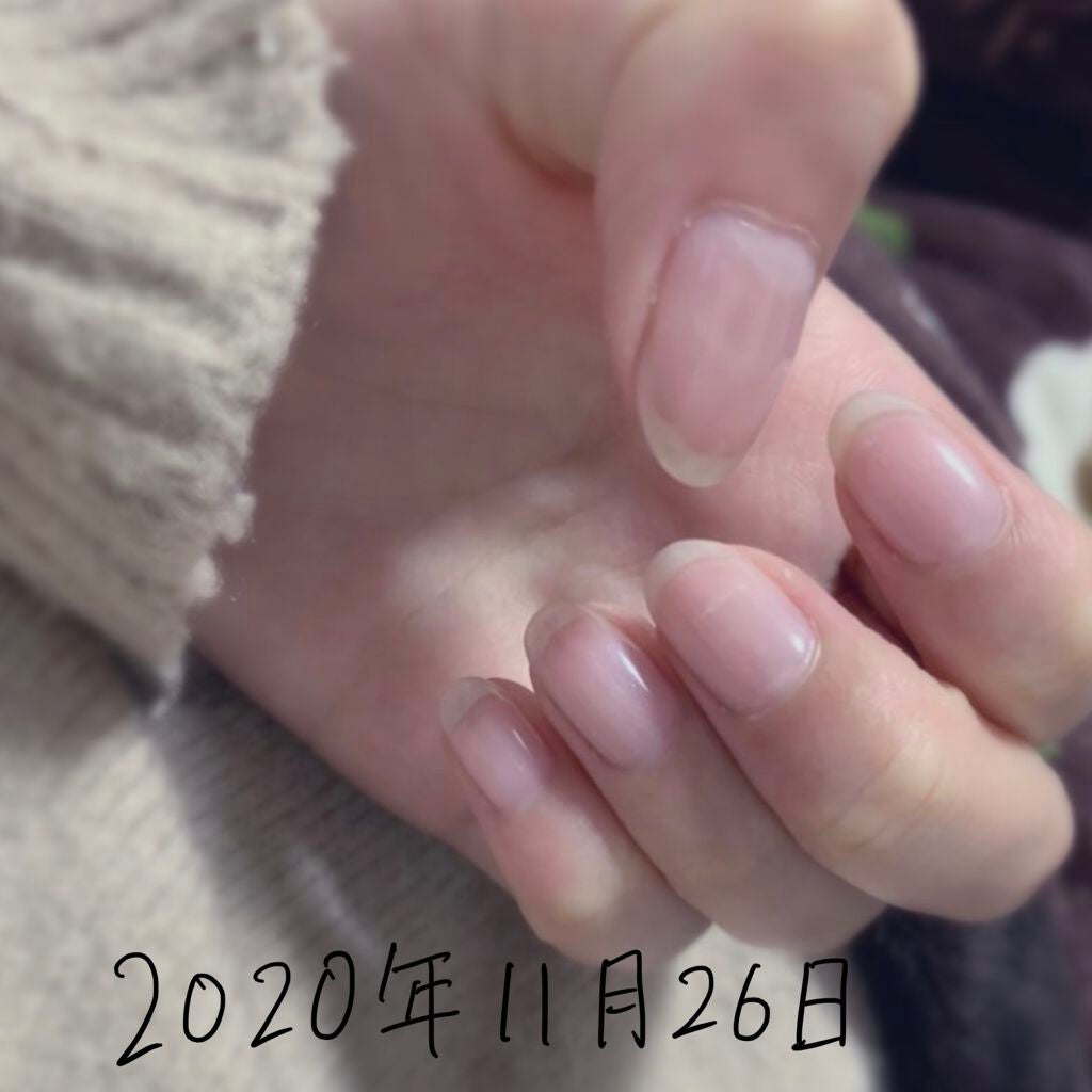 ニベアクリーム/ニベア/ボディクリームを使ったクチコミ(2枚目)