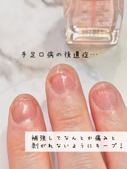 エテュセ クイックケアコート/ettusais/ネイルオイル・トリートメントを使ったクチコミ(2枚目)