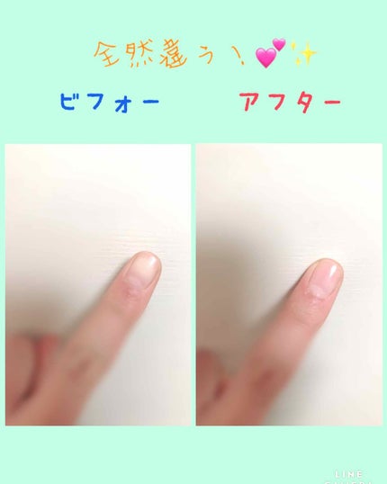 爪みがきキュピカ!/アリーナ/ネイル用品を使ったクチコミ(4枚目)