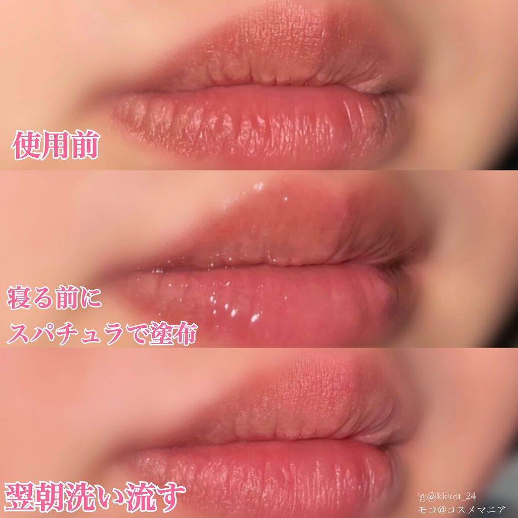 YNM リップトリートメントパック/YNM/リップマスクを使ったクチコミ(6枚目)