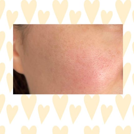 オバジC リファインローション /オバジ/化粧水を使ったクチコミ(9枚目)