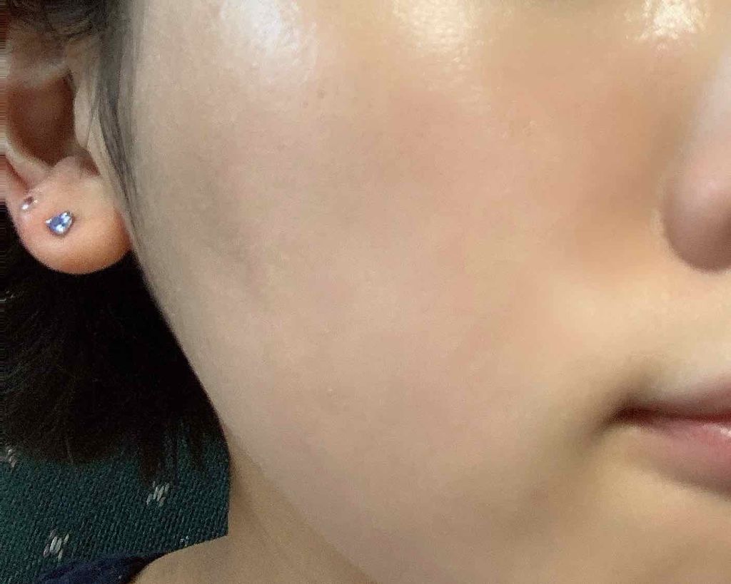 スキントリートメント ファンデーション/ナチュラグラッセ/リキッドファンデーションを使ったクチコミ（2枚目）