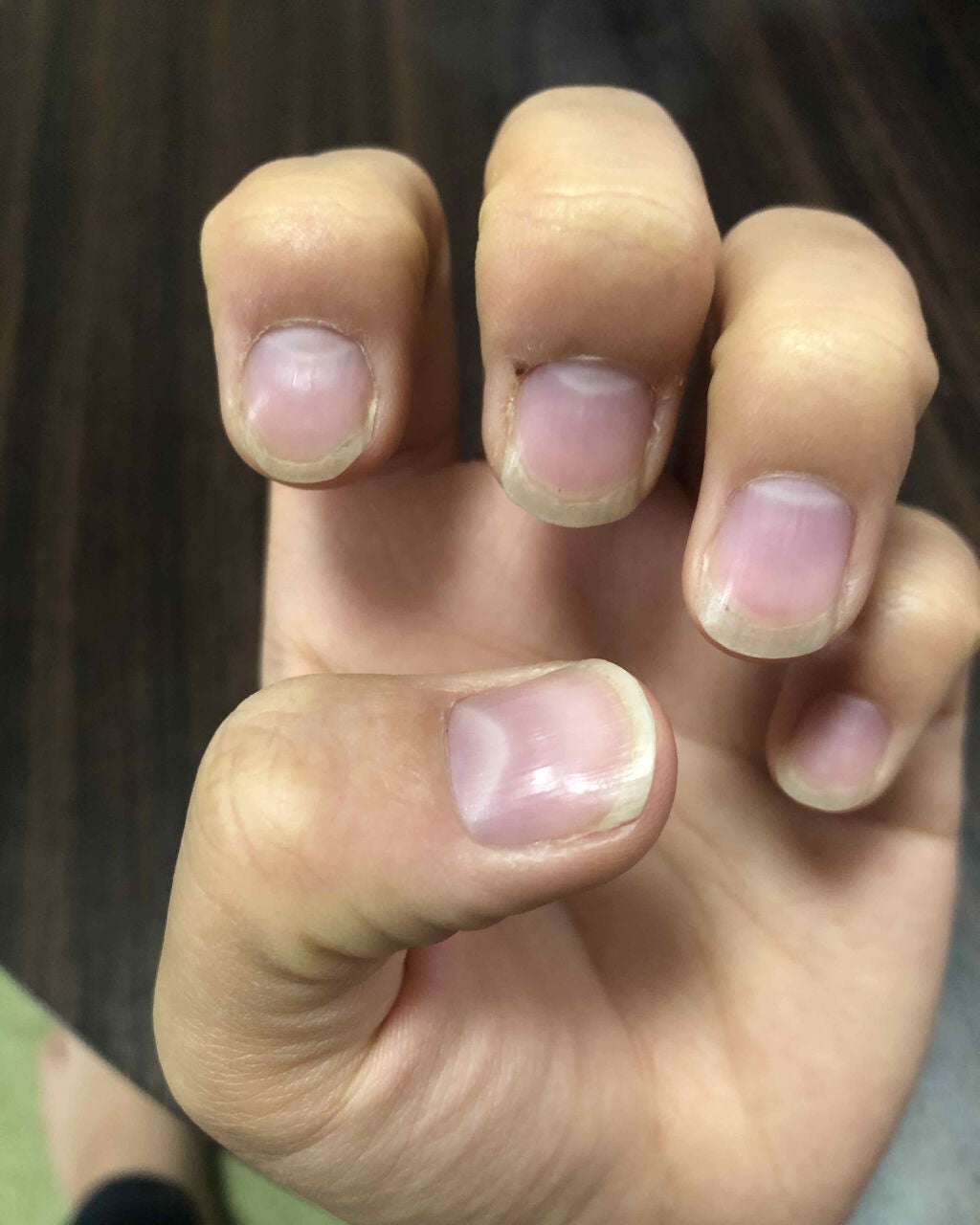 ネイルベッドオイル/アンドネイル/ネイルオイル・トリートメントを使ったクチコミ(1枚目)