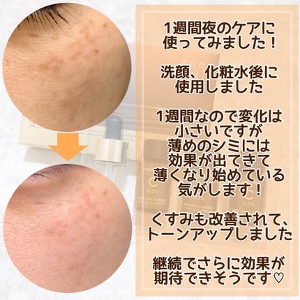 ディープビタCアンプル2.0/MEDICUBE/美容液を使ったクチコミ(4枚目)