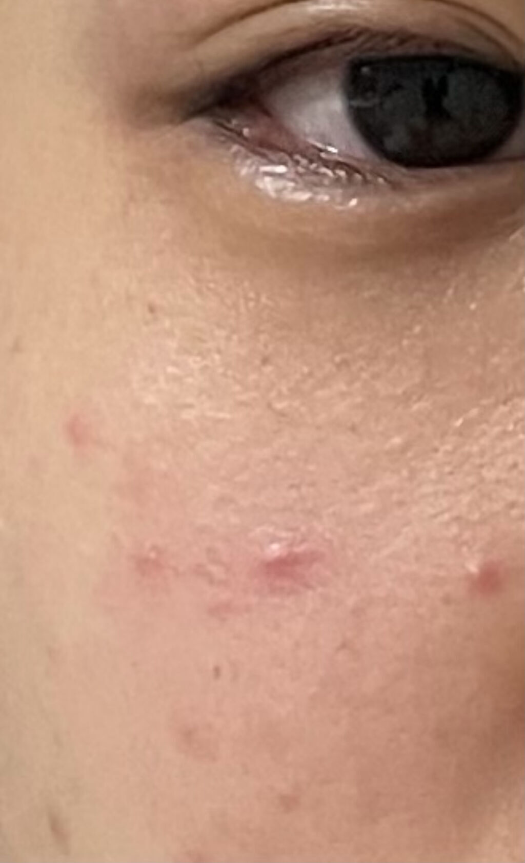 オードムーゲ 薬用ローション（ふきとり化粧水）/オードムーゲ/拭き取り化粧水を使ったクチコミ（2枚目）