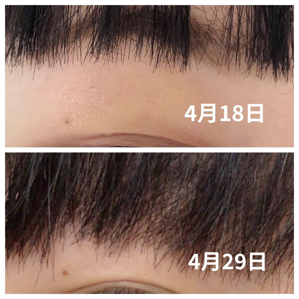 ヘアアクセルレーター レモンライムの香り/加美乃素本舗/頭皮ローションを使ったクチコミ（2枚目）