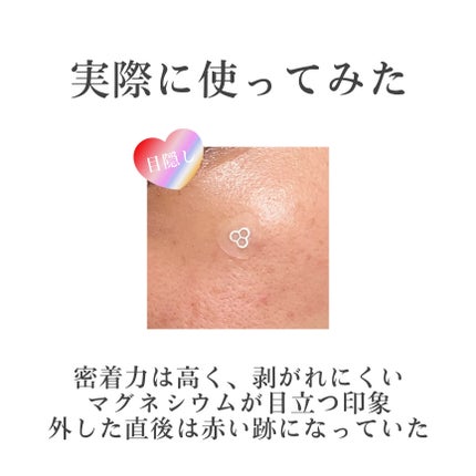 ACマグネシウムパッチ ミニ/スノーツープラス/にきびパッチを使ったクチコミ(6枚目)