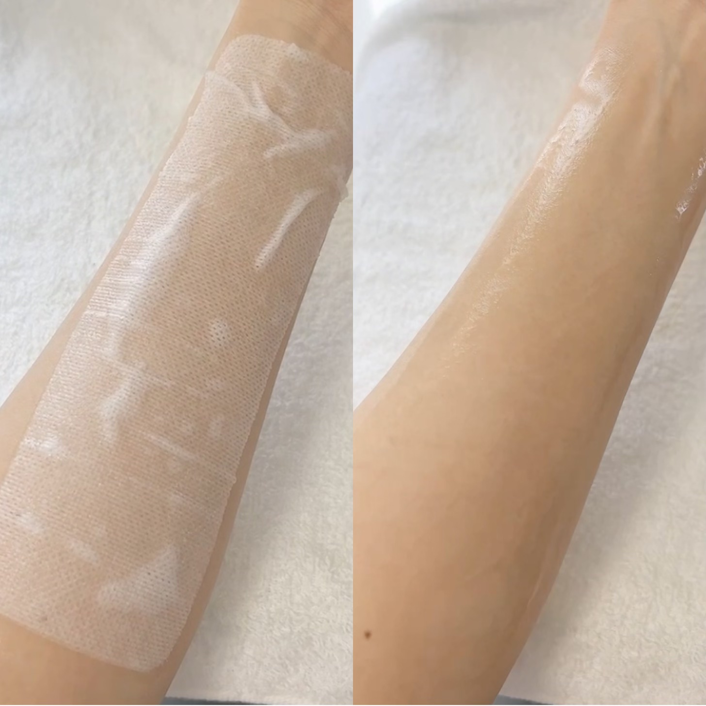 イージーチョップバンドマスク ユースシェーパー/lalachuu/シートマスク・パックを使ったクチコミ（3枚目）