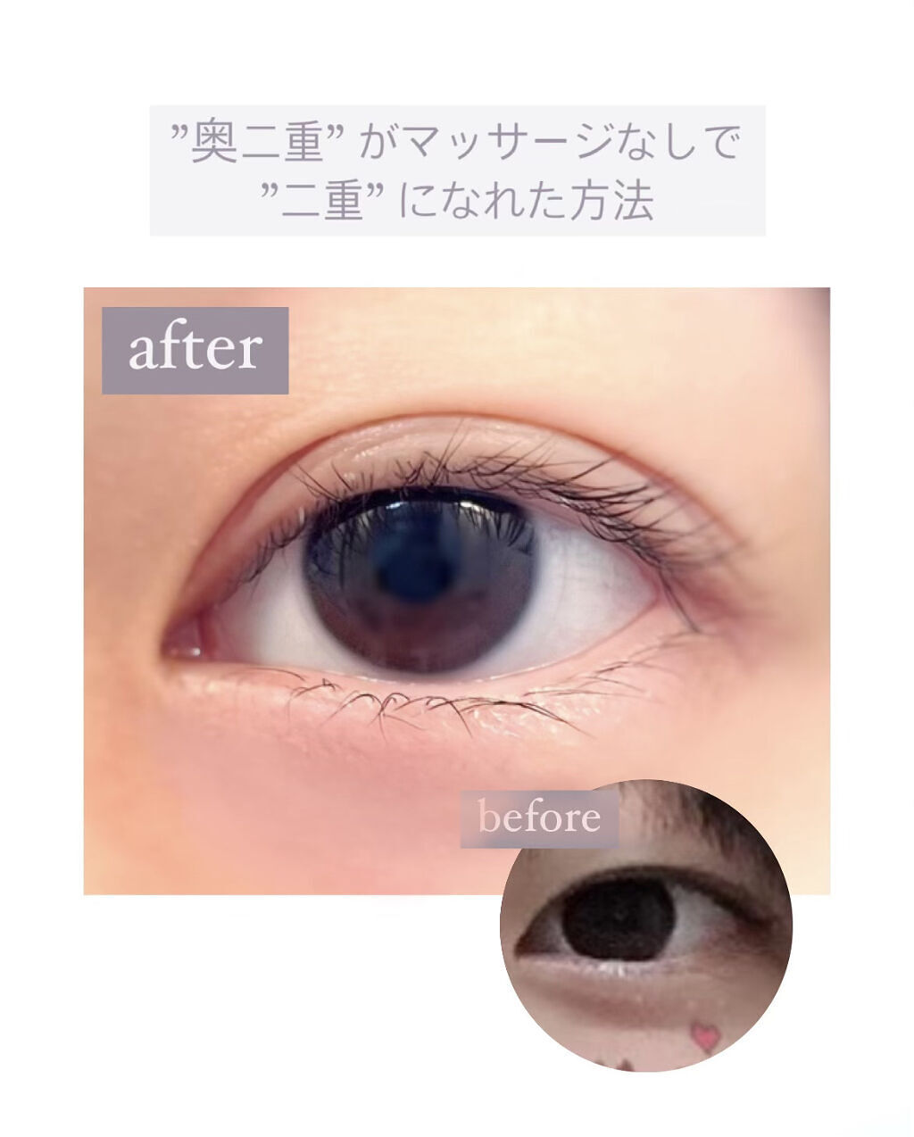 オリシキ アイリッドスキンフィルム		/D-UP/二重まぶた用アイテムを使ったクチコミ（1枚目）