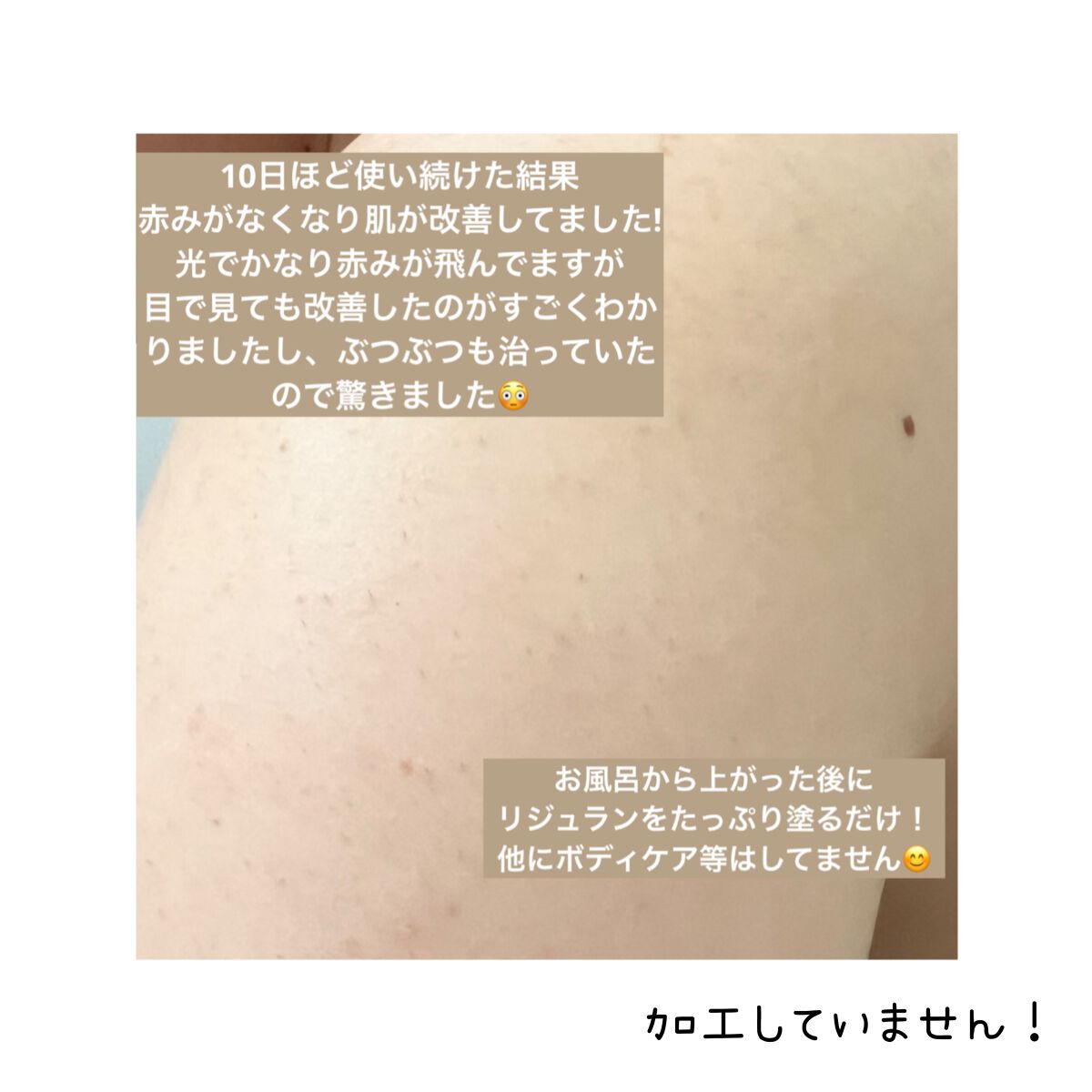 ターンオーバークリーム/REJURAN COSMETICS/フェイスクリームを使ったクチコミ（3枚目）