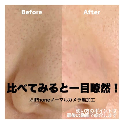 デュオ ザ クレンジングバーム ブラック/DUO/クレンジングバームを使ったクチコミ(6枚目)