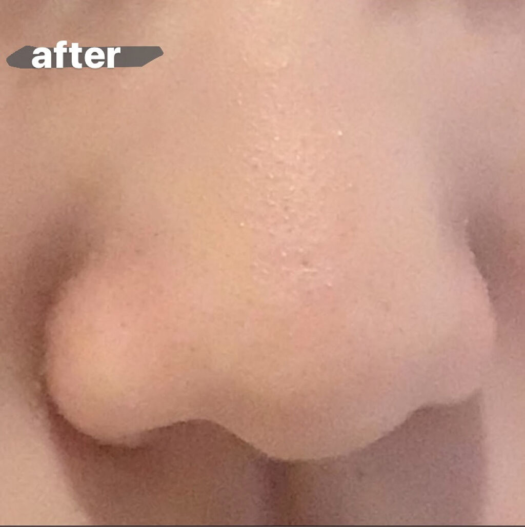 デュオ ザ クレンジングバーム ブラック/DUO/クレンジングバームを使ったクチコミ（3枚目）