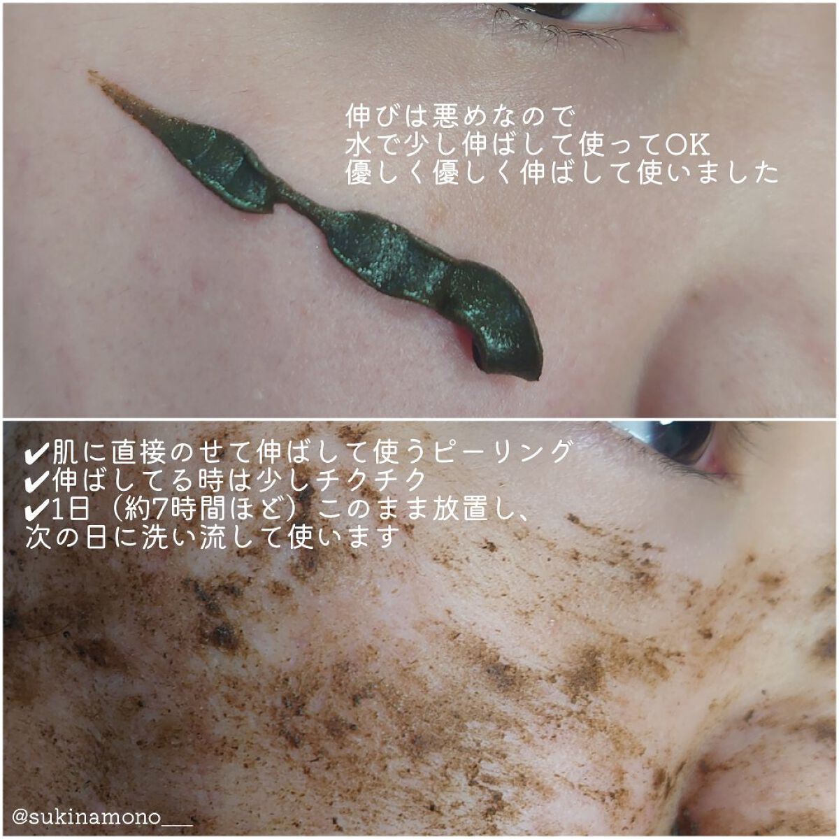 ダーマスキンピーリング/BQCELL/その他キットセットを使ったクチコミ（3枚目）