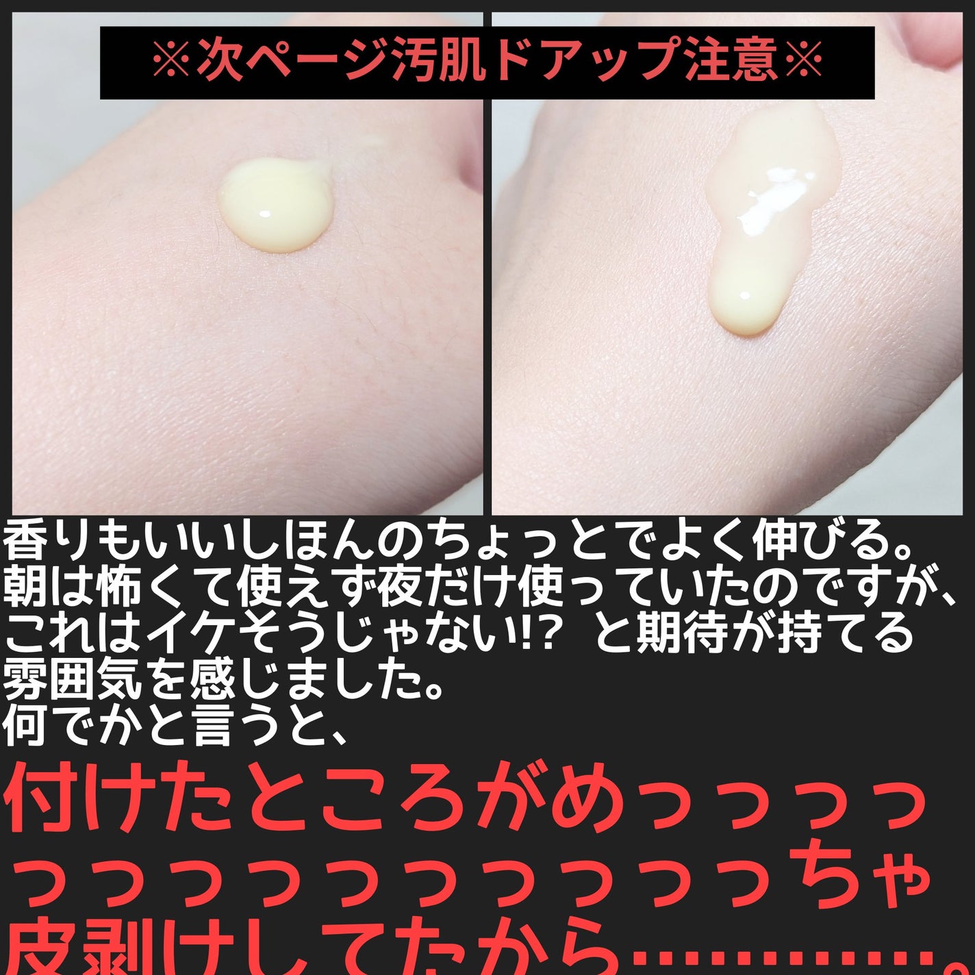 エリクシール ホワイト スポットクリアセラム WT/エリクシール/美容液を使ったクチコミ(3枚目)