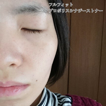 フルフィットプロポリスシナジートナー/COSRX/化粧水を使ったクチコミ(6枚目)