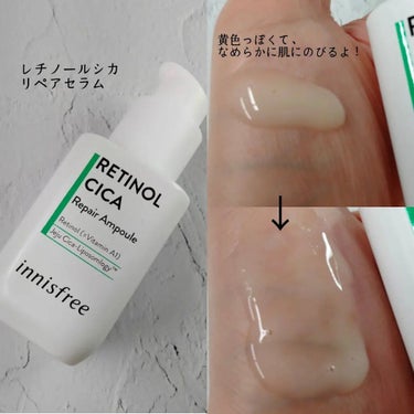 レチノール　シカ　フォーカシングパッチ/innisfree/にきびパッチを使ったクチコミ（3枚目）