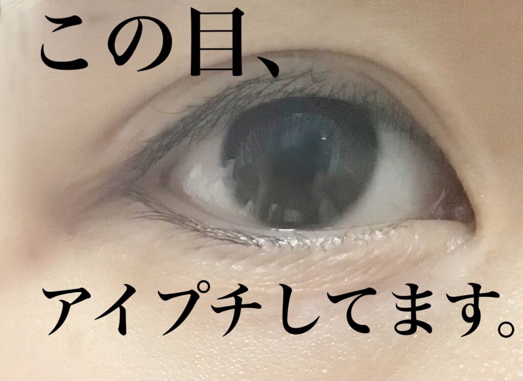 アイトーク/アイトーク/二重まぶた用アイテムを使ったクチコミ(1枚目)