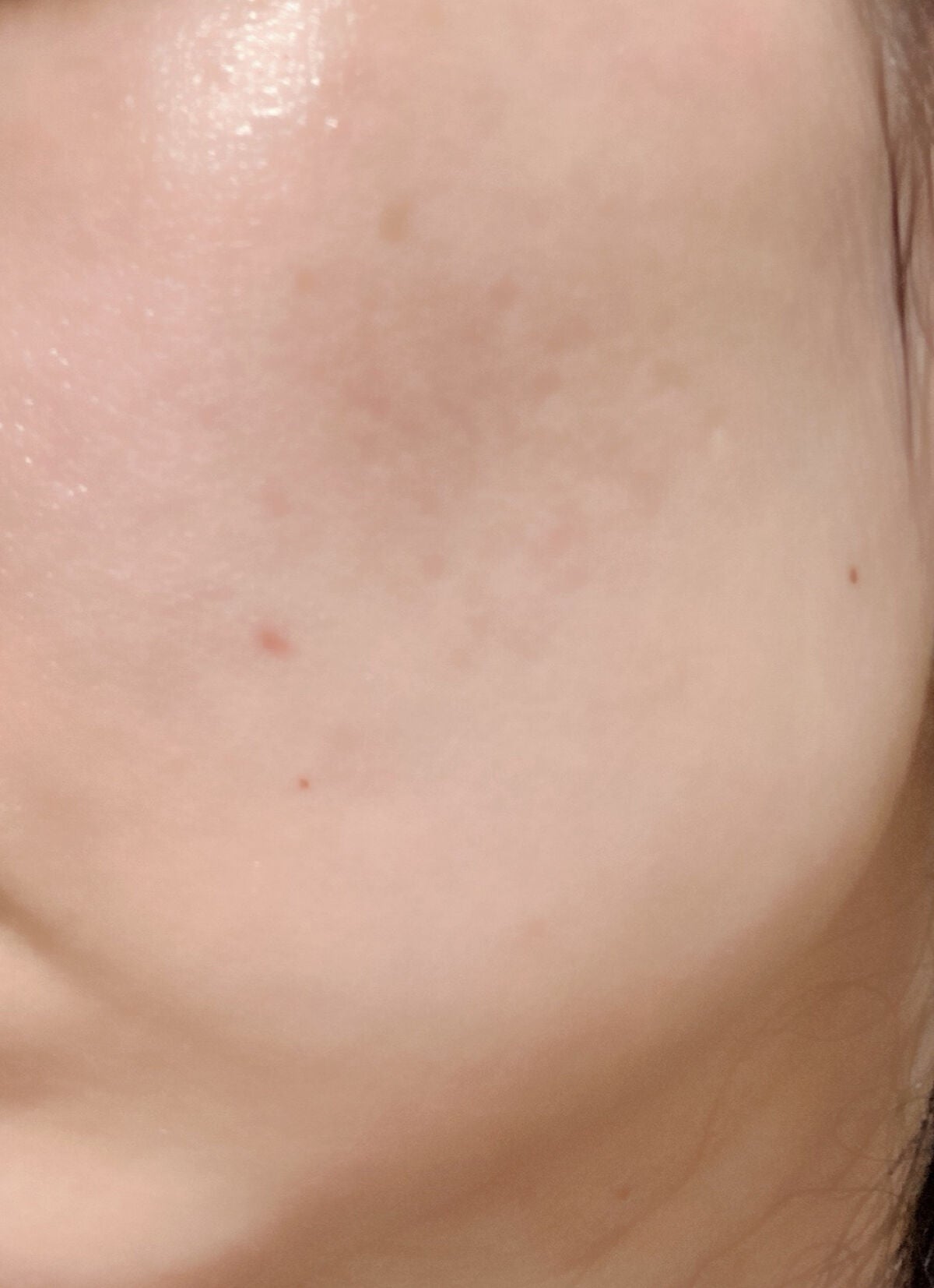 ピュアショット ライトセラム/YVES SAINT LAURENT BEAUTE/美容液を使ったクチコミ(3枚目)