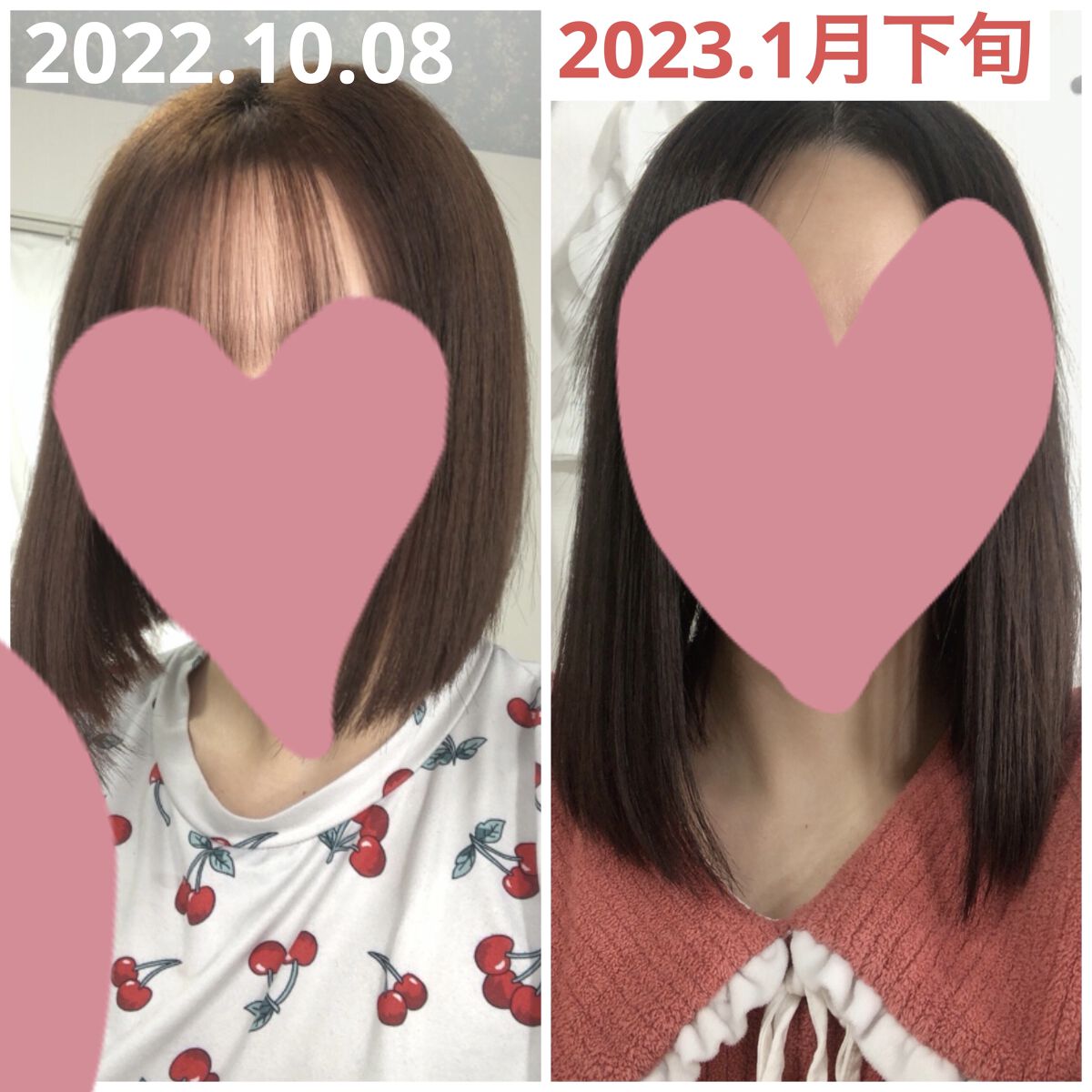 DHC 亜鉛/DHC/健康サプリメントを使ったクチコミ（2枚目）