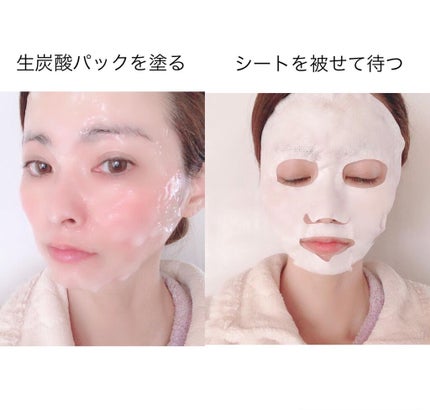 スパークリングパック/Urar /シートマスク・パックを使ったクチコミ(4枚目)